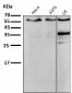 Anti-ER alpha ESR1 Rabbit Monoclonal Antibody